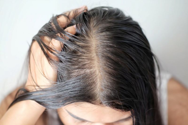 tóc dầu bết